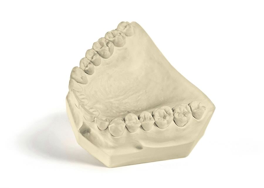 Gesso Odontológico e sua importância para a Odontologia
