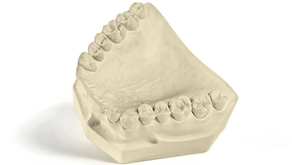 Gesso Odontológico e sua importância para a Odontologia